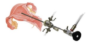 Hysteroscope 1.JPG3